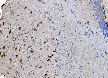 Anti-GABARAP Antibody