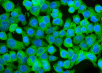 Anti-GCHFR Antibody