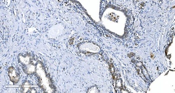 GCHFR Antibody
