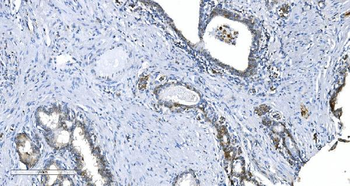 Anti-GCHFR Antibody