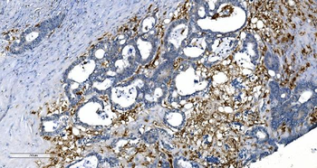 Anti-GCHFR Antibody
