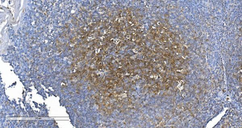 Anti-GCHFR Antibody