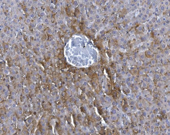 Anti-GCHFR Antibody