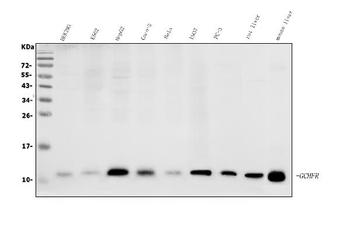 Anti-GCHFR Antibody