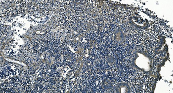 Anti-GNG7 Antibody