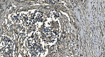 Anti-GNG7 Antibody
