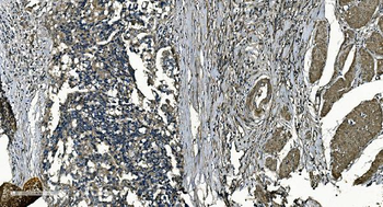 Anti-GNG7 Antibody
