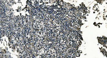 Anti-GNG7 Antibody