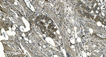 Anti-GNG7 Antibody
