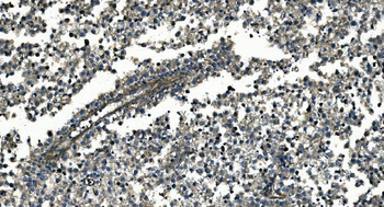 Anti-GNG7 Antibody