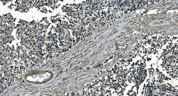 Anti-GNG7 Antibody