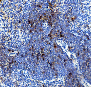 Anti-IL4R Antibody