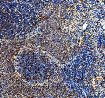 Anti-IL10 Antibody