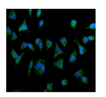 Anti-IL2 Receptor beta/p75/IL2RB Antibody