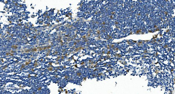 Anti-IL2 Receptor beta/p75/IL2RB Antibody