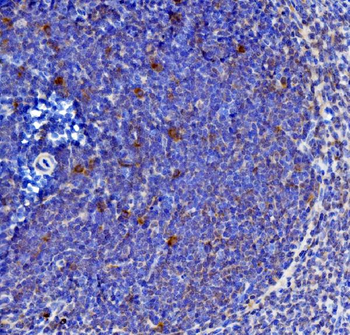 Anti-IL-21/Il21 Antibody