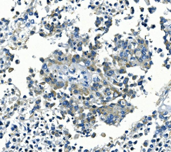 Anti-Kir6.1/KCNJ8 Antibody