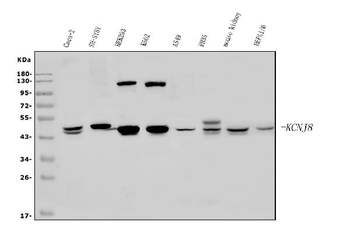 Anti-Kir6.1/KCNJ8 Antibody