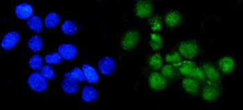 Anti-METTL1 Antibody