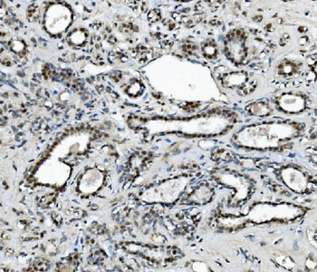 Anti-METTL1 Antibody