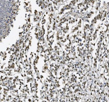 Anti-METTL1 Antibody
