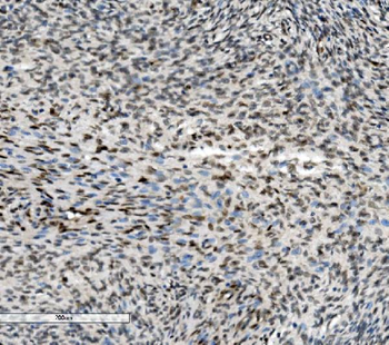 Anti-METTL1 Antibody