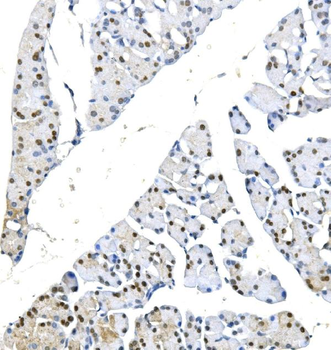 Anti-METTL1 Antibody