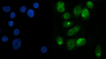 METTL3 Antibody