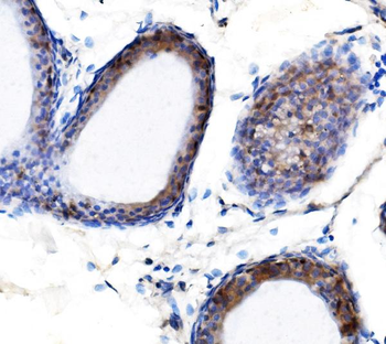 METTL3 Antibody