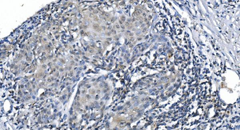 METTL3 Antibody