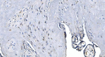 METTL3 Antibody