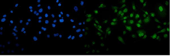 METTL3 Antibody