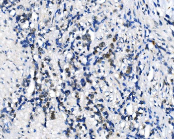 METTL3 Antibody
