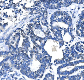 METTL3 Antibody