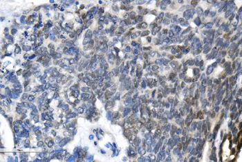 METTL3 Antibody