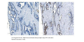 Anti-METTL14 Antibody