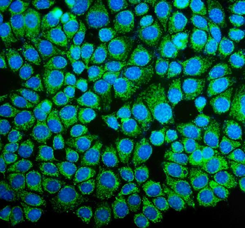 Anti-NDUFB10 Antibody