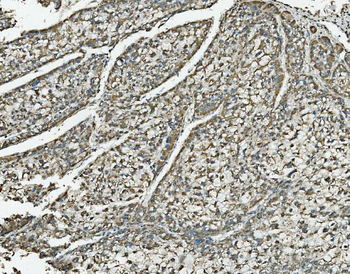 Anti-NDUFB10 Antibody