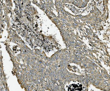 Anti-NDUFB10 Antibody