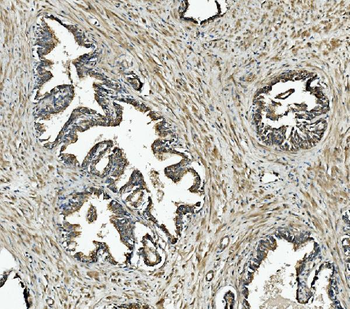 Anti-NDUFB10 Antibody