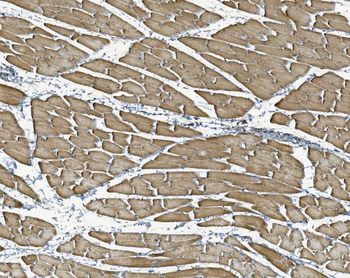 Anti-NDUFB10 Antibody