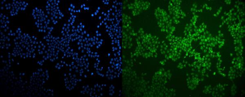 Anti-LXR beta/NER/NR1H2 Antibody