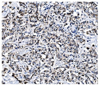 Anti-PCBP1 Antibody