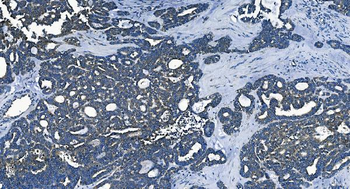 Anti-PCBP2/hnRNP E2 Antibody