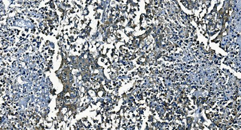 Anti-PCBP2/hnRNP E2 Antibody