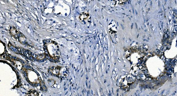 Anti-PCBP2/hnRNP E2 Antibody