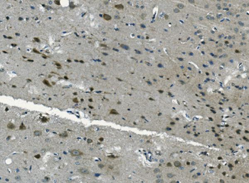 Anti-PCBP2/hnRNP E2 Antibody
