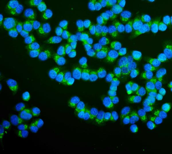 Anti-RAB1B Antibody