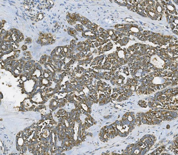 Anti-RAB1B Antibody