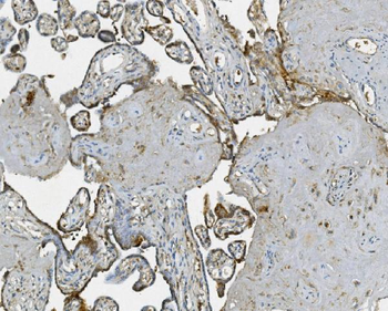 Anti-RAB1B Antibody